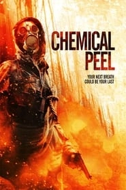 Chemical Peel hd